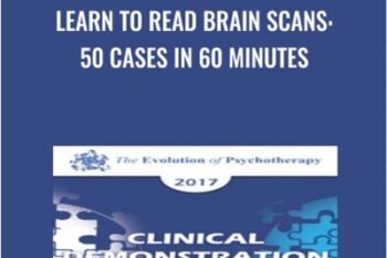 Learn to Read Brain Scans: 50 cases in 60 Minutes - Daniel Amen