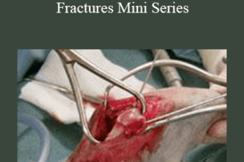 CPD - MS053 – How To Fix Fractures Mini Series