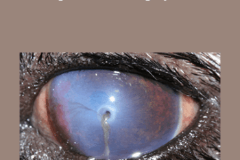 CPD - MS179 Ophthalmic Surgery Mini Series