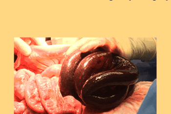 CPD - MS202 – Focus on Emergency Surgery