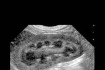 CPD - MS205 – Abdominal Ultrasound