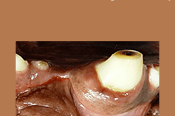 CPD - MS206 – Dental Investigation & Xray