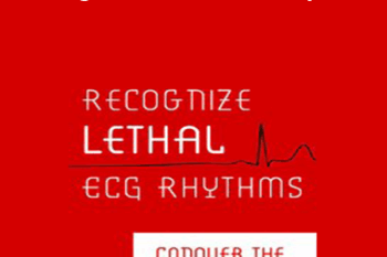 Robin Gilbert - Recognize Lethal ECG Rhythms: Conquer the Patient Clues