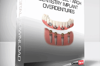Fast Track Full – Arch Dentistry Implant Overdentures