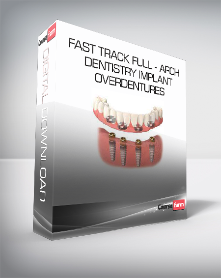 Fast Track Full – Arch Dentistry Implant Overdentures